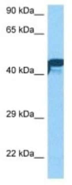 NYX Rabbit anti-Human, Polyclonal, Novus Biologicals:Antibodies:Primary
